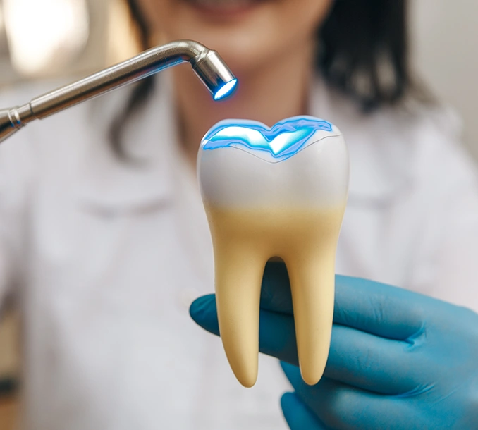 What are the advantages of Composite White Fillings? - Bayswater Dental Clinic