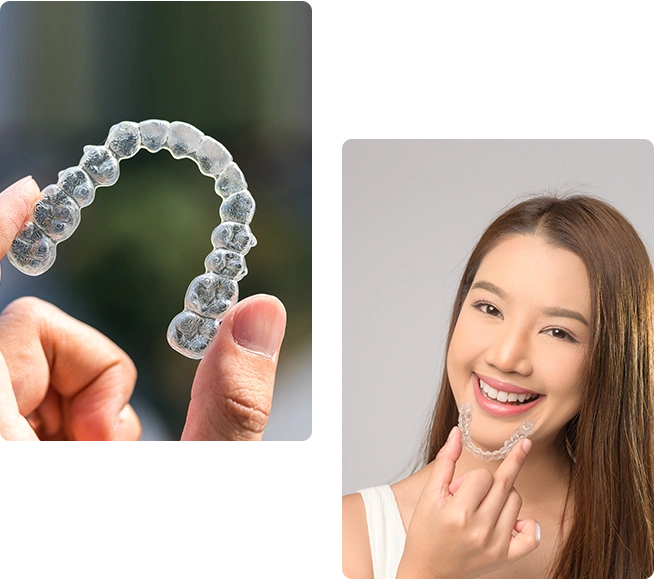 Alternative package offers to Invisalign at Bayswater Dental Clinic