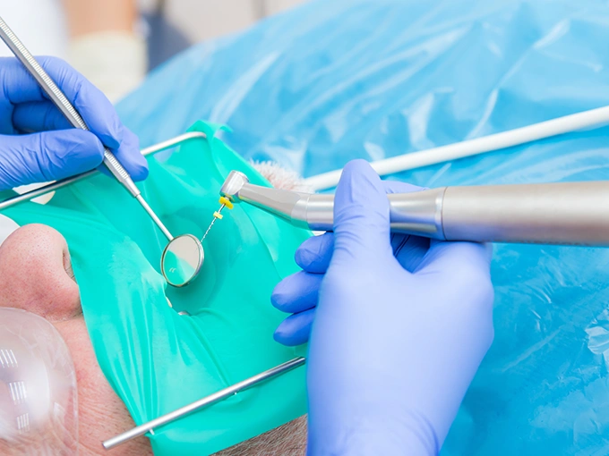 Cost of root canal treatment in London at Bayswater Dental Clinic