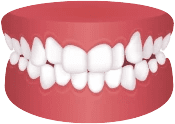 Crowded Teeth Icon