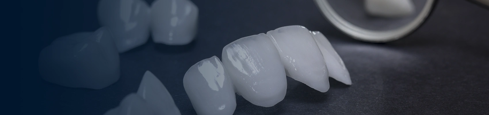 Dental Veneers at Bayswater Dental Clinic in London banner image