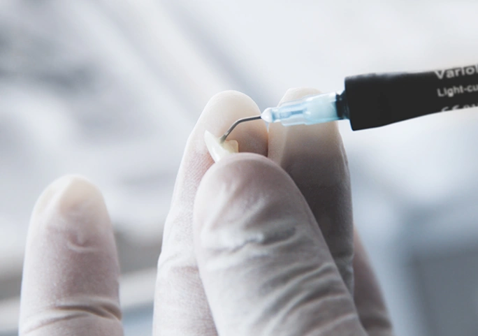 Do Dental Veneers need special care and maintenance?