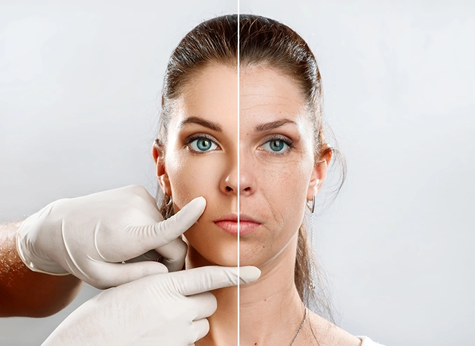 How Platelet Rich Plasma Treatment different from Dermal Fillers?