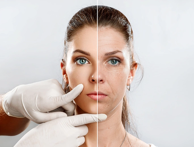 History of Dermal Fillers - Bayswater Dental Clinic