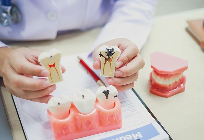 Importance of a Dental Hygienist