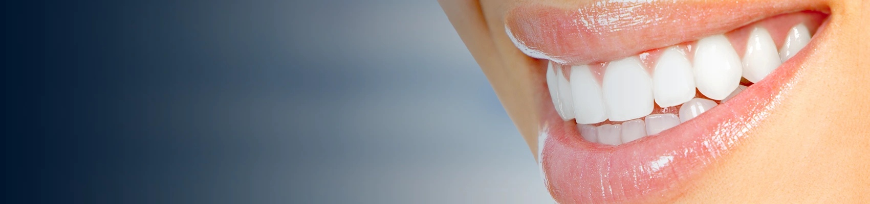 Laser Gum Contouring London Banner Image 