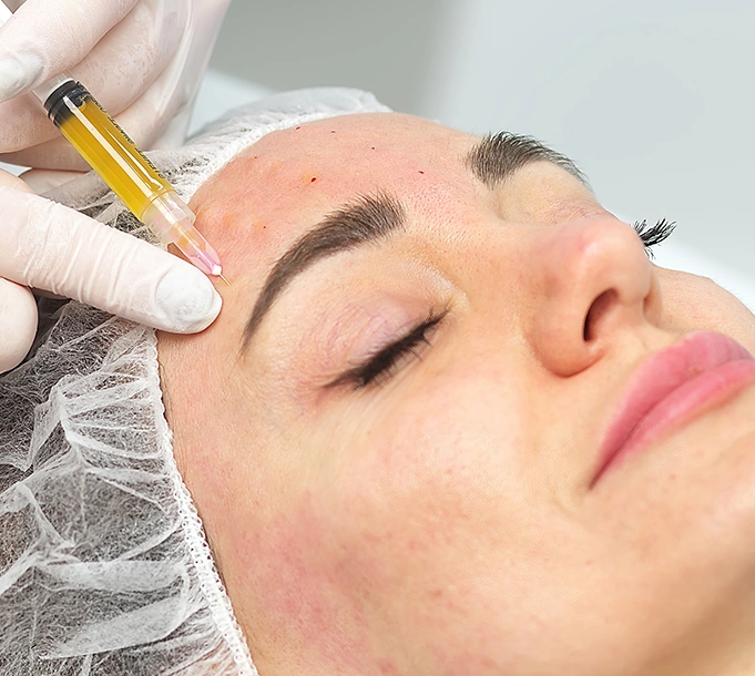 Non-Surgical Rhinoplasty in London by Bayswater Dental Clinic