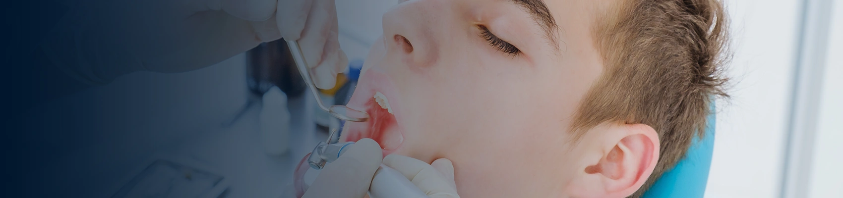 Top Dental Clinic for Painless Root Canal Treatment in London