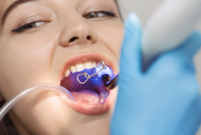 Safe limits of tooth contouring - Explained by Bayswater Dental Clinic