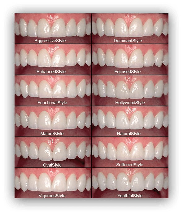 Smile Design style at Bayswater Dental Clinic London