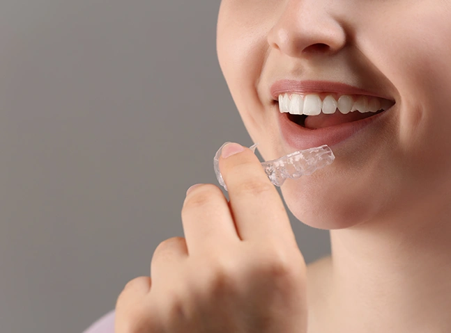 Special Offers on Invisalign at Bayswater Dental Clinic 