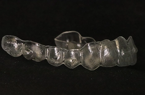 Suresmile clear aligners in London