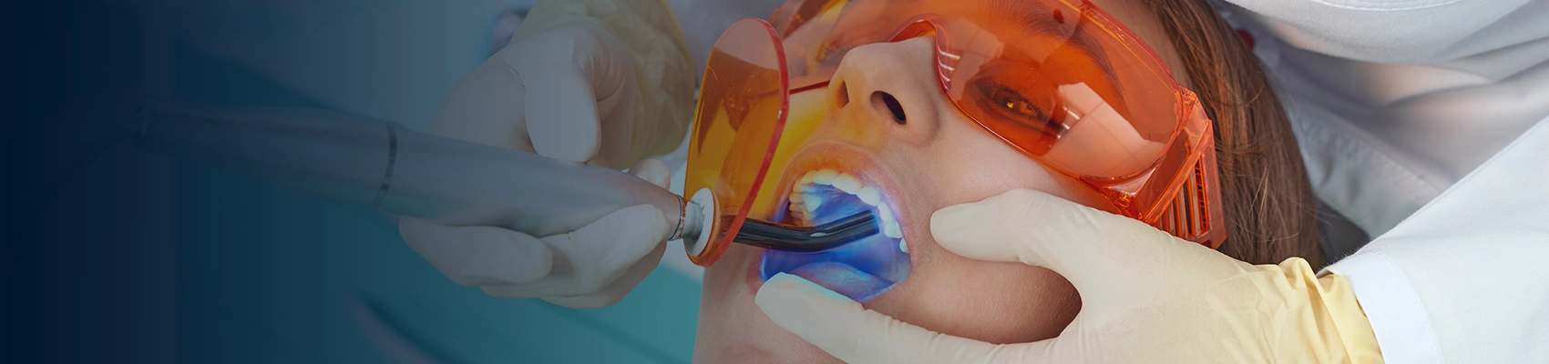 Tooth Coloured Fillings at Bayswater Dental Clinic banner image