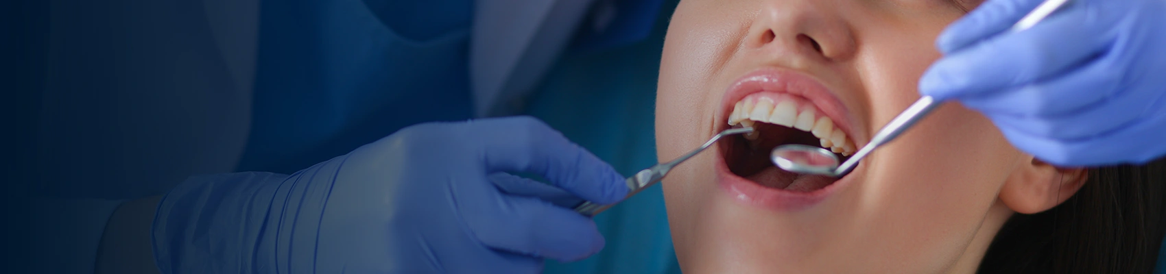 Tooth Contouring banner Image 